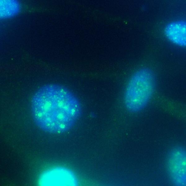 Cells NCEPT