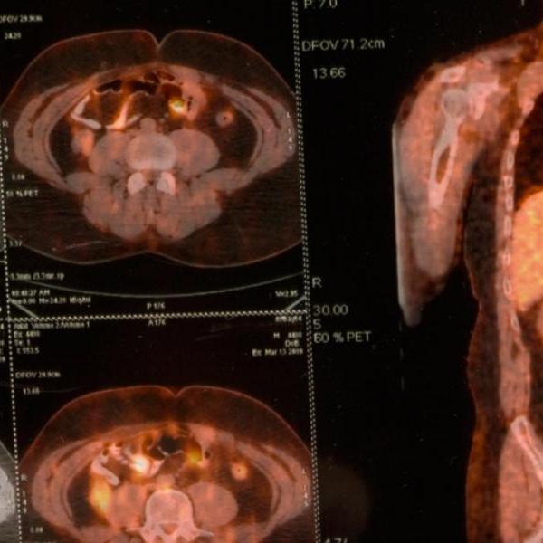 A picture of a PET radioisotope