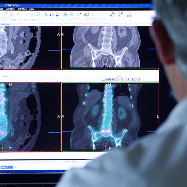 Doctors viewing a SPECT scan