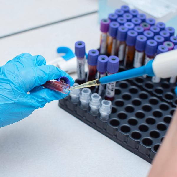 blood test