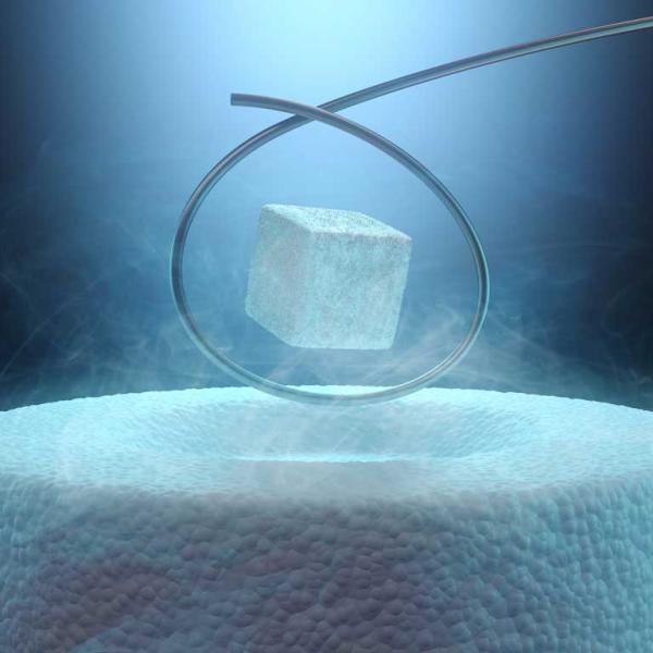 Superconductivity