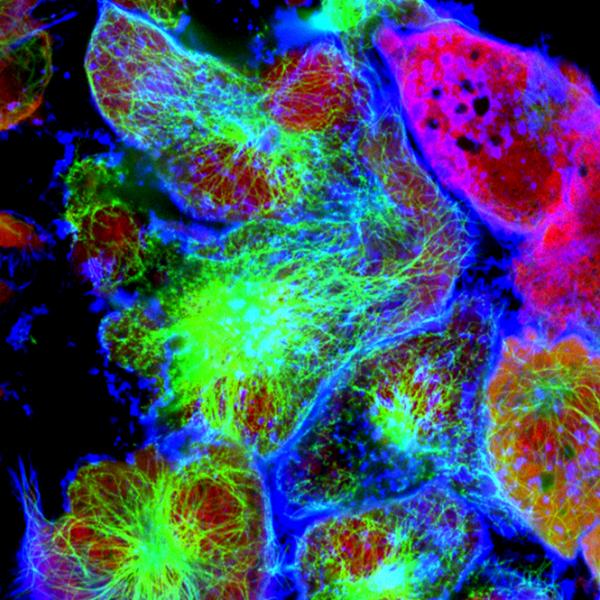 Cancer cells