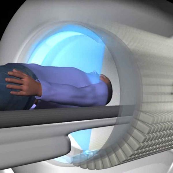 Full body PET scan
