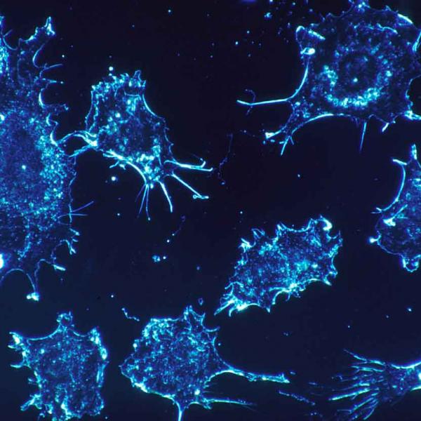 Cancer cells