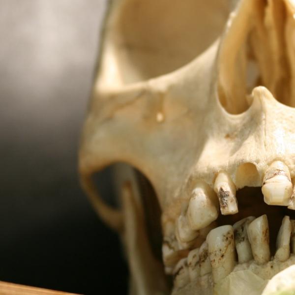 human skull