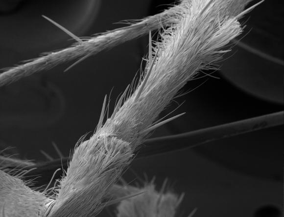 Spider's leg magnified 149x
