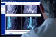 Doctors viewing a SPECT scan