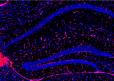 TSPO expression in the hippocampal region of a mouse brain