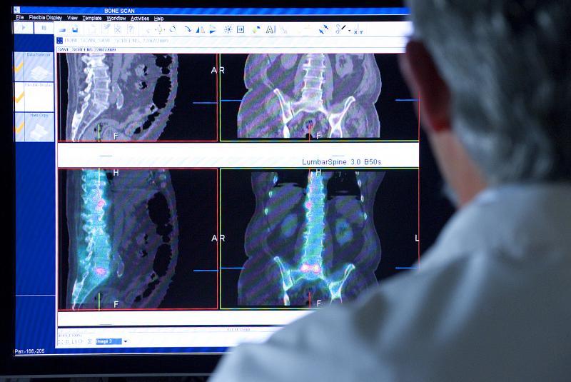 Doctor viewing SPECT scan