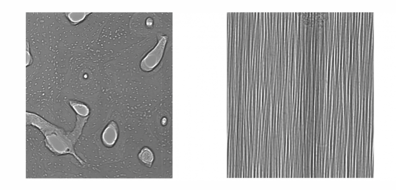 X-ray phase-contrast images